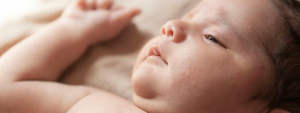 Izsitumi un apsārtums bērnam: iespējamie cēloņi un ārstēšana