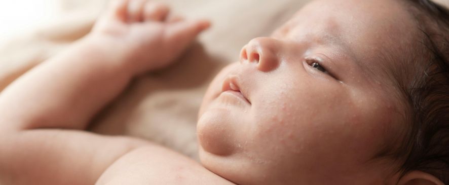 Izsitumi un apsārtums bērnam: iespējamie cēloņi un ārstēšana