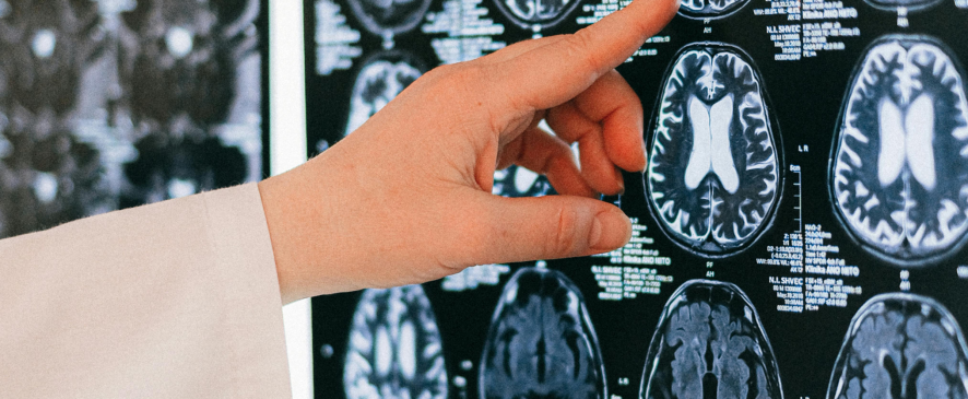 Neirogrāfija un elektromiogrāfija – precīzas un drošas nervu un muskuļu izmeklēšanas metodes