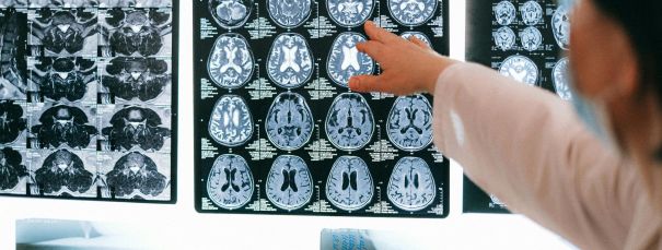 Ko var un ko nevar atklāt ar elektromiogrāfiju, neirogrāfiju?