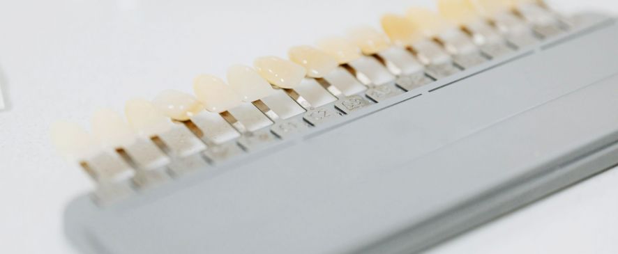 Отбеливание зубов: как проходит процедура и сколько держится результат