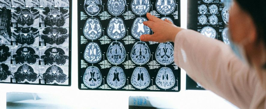 Что можно и что нельзя выявить с помощью электромиографии и нейрографии?